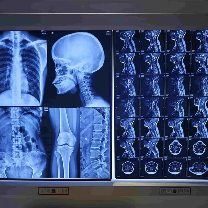 Conventional X Ray Film